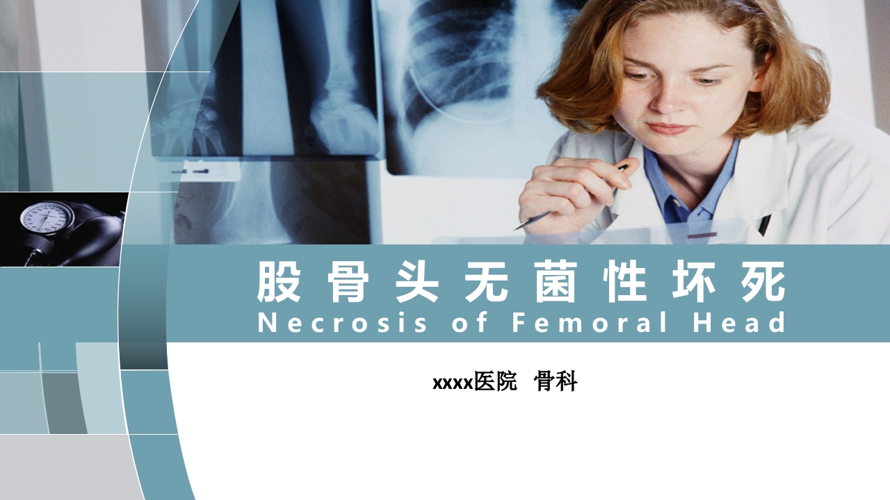 股骨头无菌性坏死PPT课件.ppt