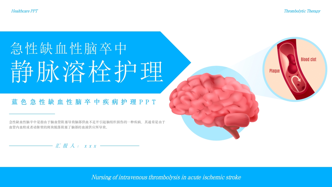 急性缺血性脑卒中静脉溶栓护理疾病护理护理查房PPT课件.pptx