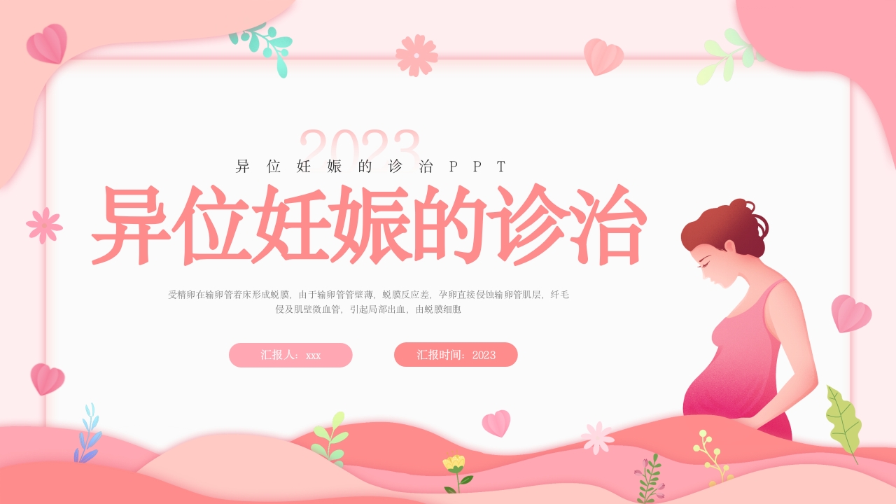 异位妊娠的诊治PPT课件.pptx