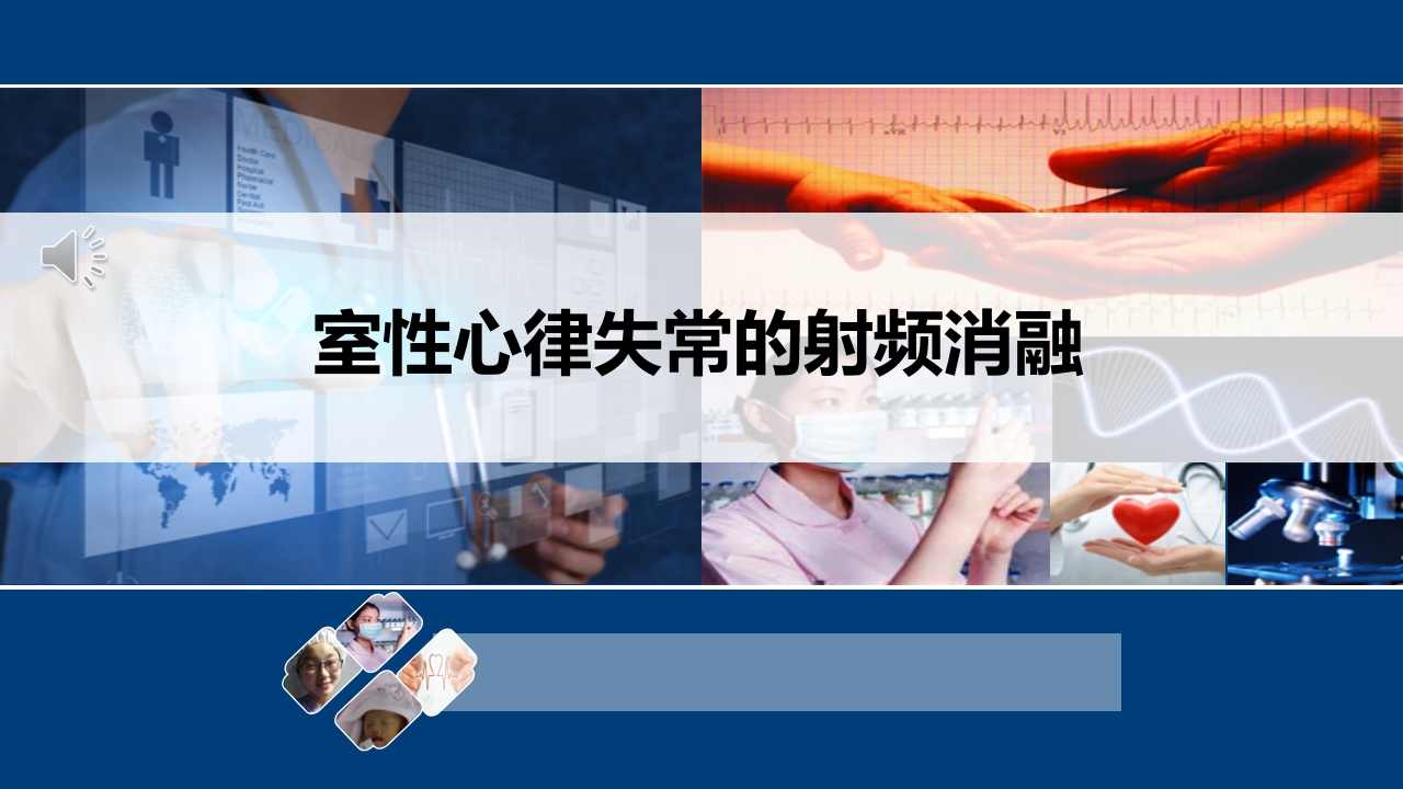 室性心律失常的射频消融治疗ppt课件.pptx