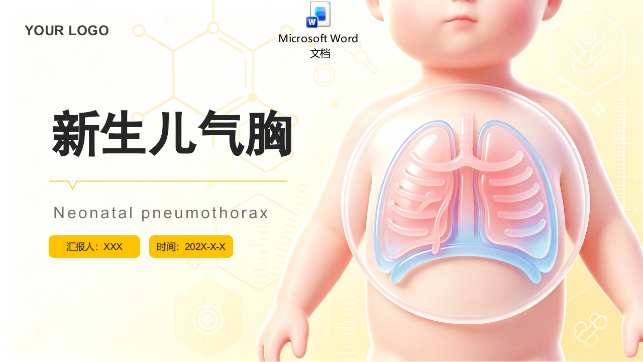 新生儿气胸护理查房气胸患者PPT课件+word讲稿.pptx