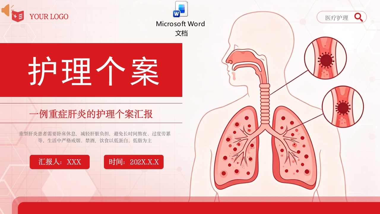 重症肝炎护理个案PPT课件+word讲稿.pptx